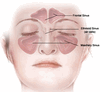 What are Sinuses?